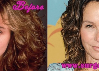 Jennifer Grey Plastic Surgery