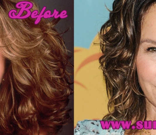 Jennifer Grey Plastic Surgery