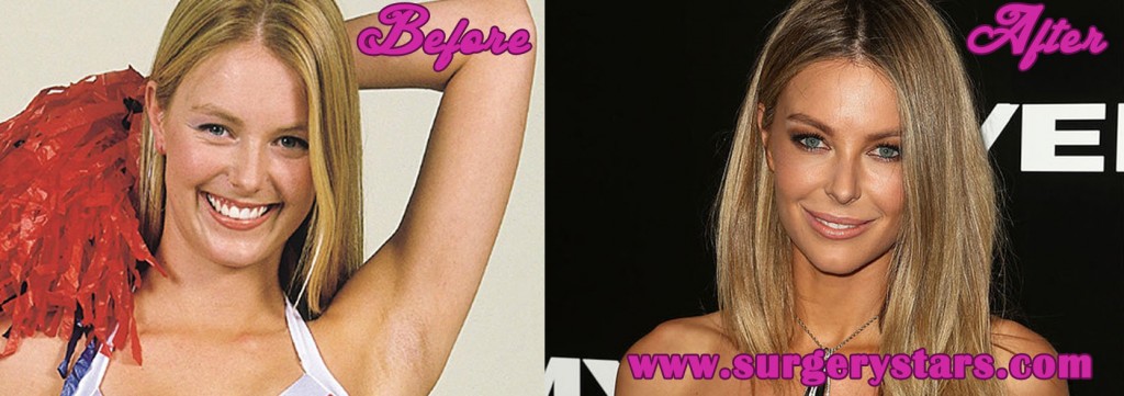 Jennifer Hawkins Plastic Surgery