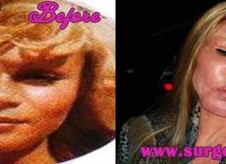 Jocelyn Wildenstein Before and After
