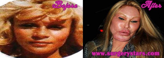 Jocelyn Wildenstein Before and After
