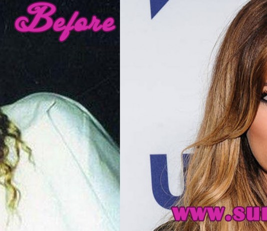 Khloe Kardashian Plastic Surgery