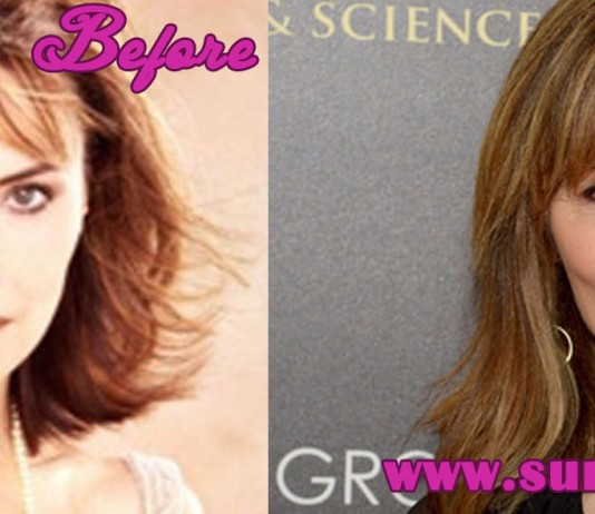 Lauren Koslow Plastic Surgery