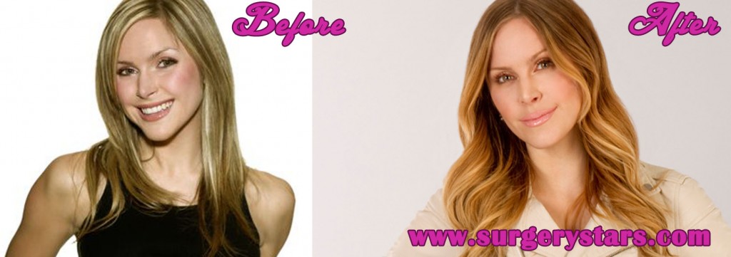 Leah Miller Plastic Surgery