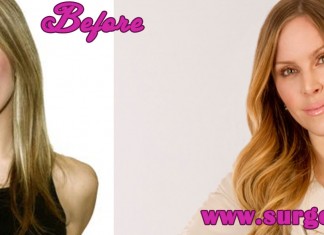 Leah Miller Plastic Surgery