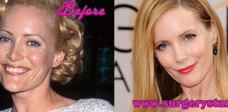 leslie mann plastic surgery