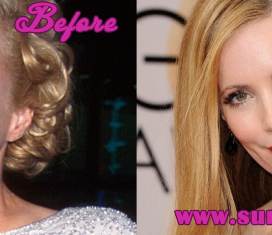 leslie mann plastic surgery