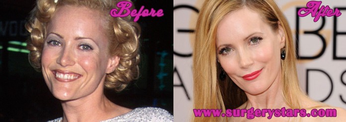 leslie mann plastic surgery