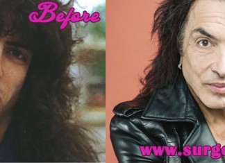 Paul Stanley Plastic Surgery