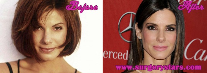 Sandra Bullock Plastic Surgery