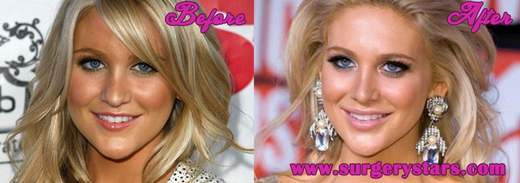 Stephanie Pratt Plastic Surgery