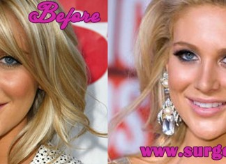 Stephanie Pratt Plastic Surgery