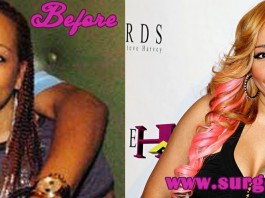 Tiny Harris Plastic Surgery