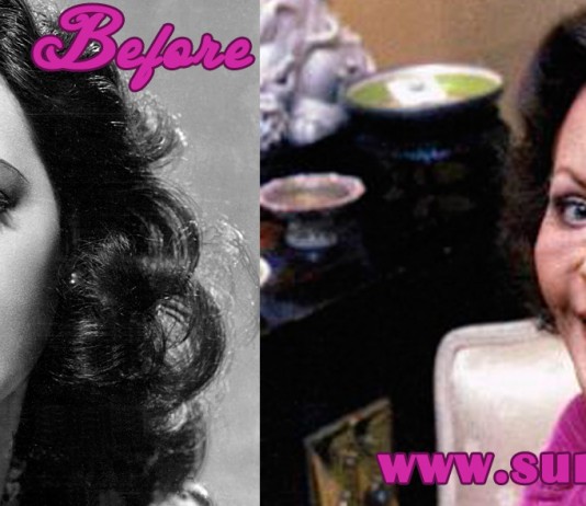 Hedy Lamarr Plastic Surgery