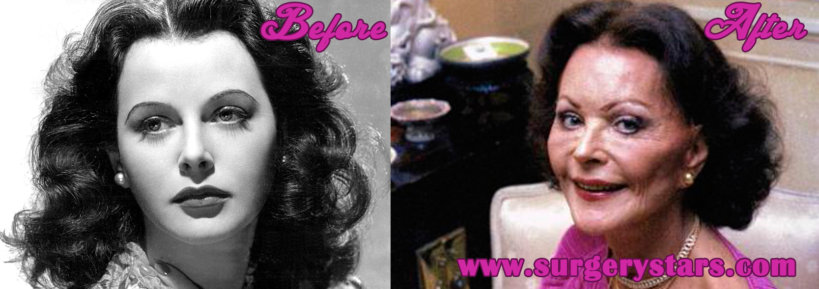 Hedy Lamarr Plastic Surgery - Before and After Pictures.