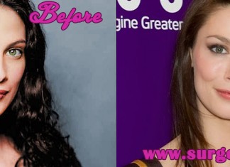 Joanne Kelly Plastic Surgery