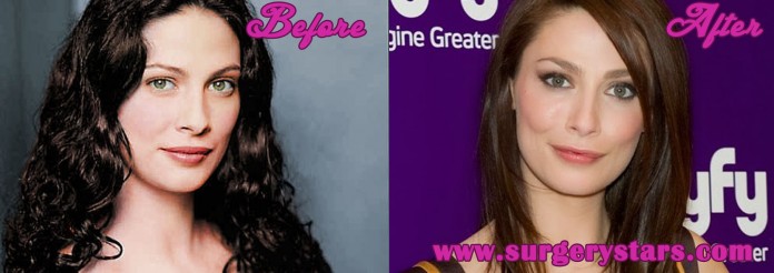 Joanne Kelly Plastic Surgery