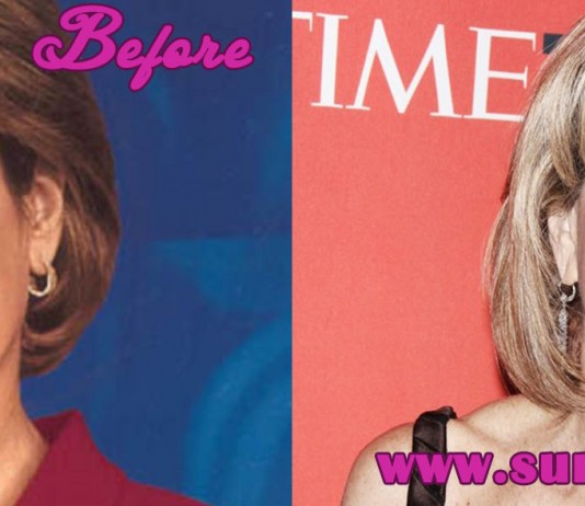 Andrea Mitchell Facelift