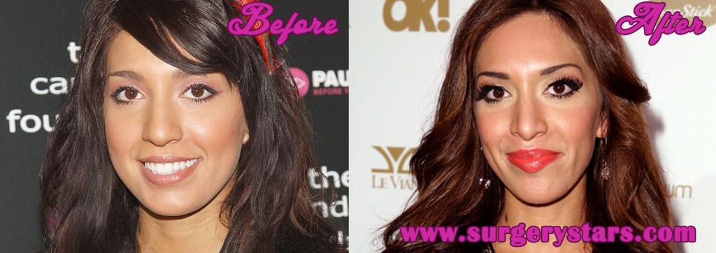 Farrah Abraham Plastic Surgery Before And After Pics
