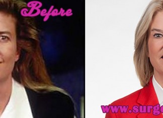 Greta Van Susteren Before and after