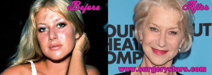 Helen Mirren Plastic Surgery