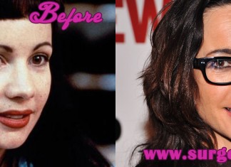 Janeane Garofalo Plastic Surgery