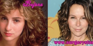 Jennifer Grey Before and after