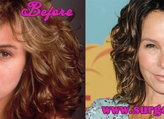 Jennifer Grey Before and after