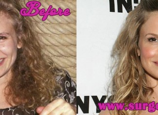 Kyra Sedgwick Plastic Surgery