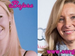 Lisa Kudrow Plastic Surgery