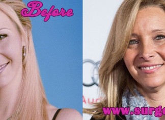 Lisa Kudrow Plastic Surgery