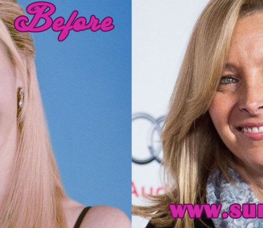 Lisa Kudrow Plastic Surgery