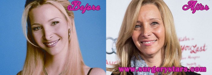 Lisa Kudrow Plastic Surgery