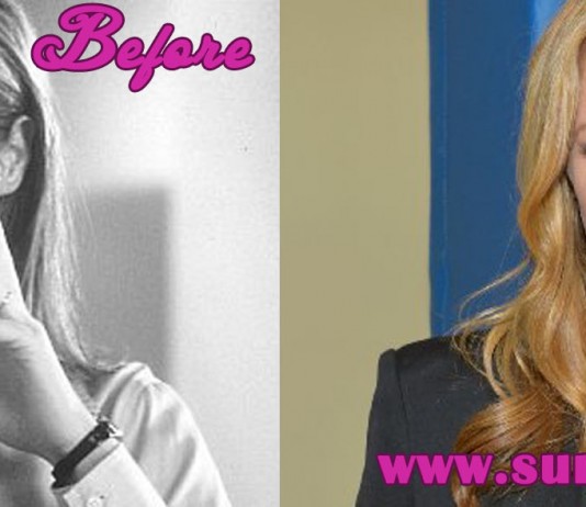 Mary Mccormack Plastic Surgery