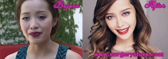 Michelle Phan Plastic Surgery