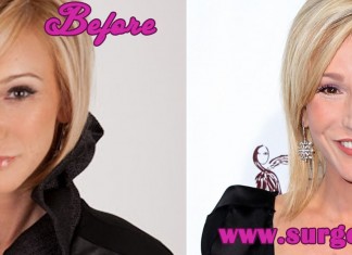 Paula White Plastic Surgery