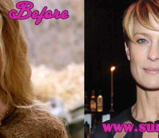 Robin Wright Penn Plastic Surgery