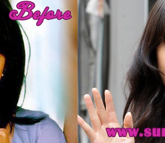 song hye kyo plastic surgery