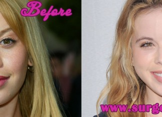 Tara Lipinski Plastic Surgery