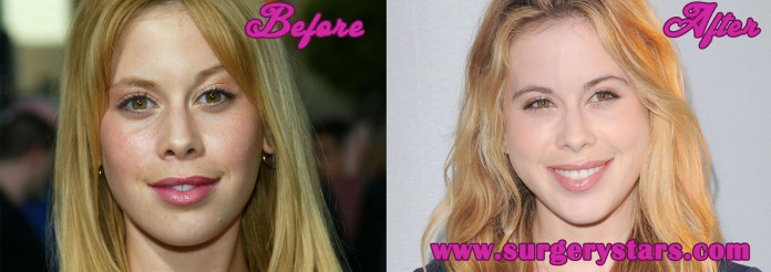 Tara Lipinski Plastic Surgery