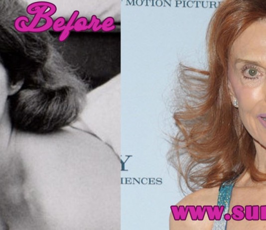 Tina Louise Plastic Surgery