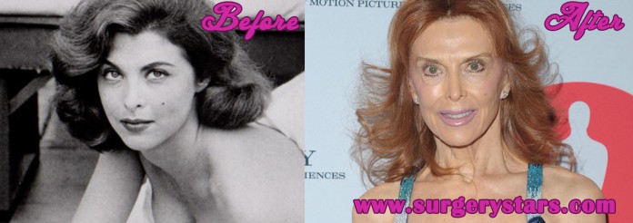 Tina Louise Plastic Surgery