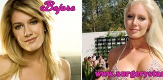 10 celebrities with breast implants