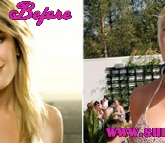 10 celebrities with breast implants