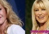 10 celebrities with plastic surgery