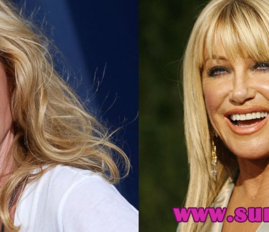 10 celebrities with plastic surgery