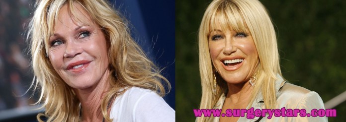 10 celebrities with plastic surgery