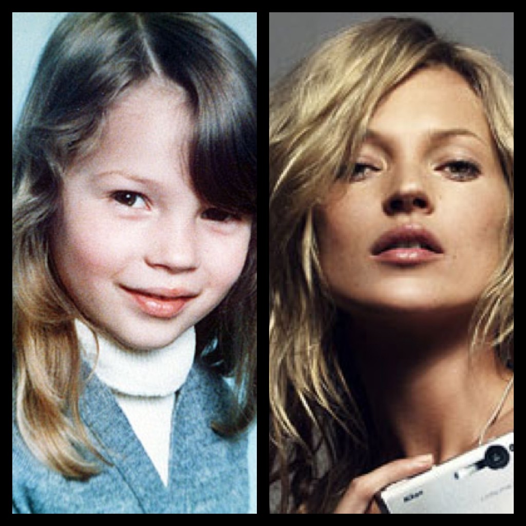 Kate moss nose job before and after
