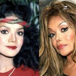 Latoya Jackson before and after plastic surgery