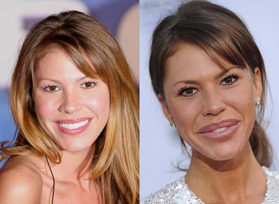 Nikki Cox before and after plastic surgery.